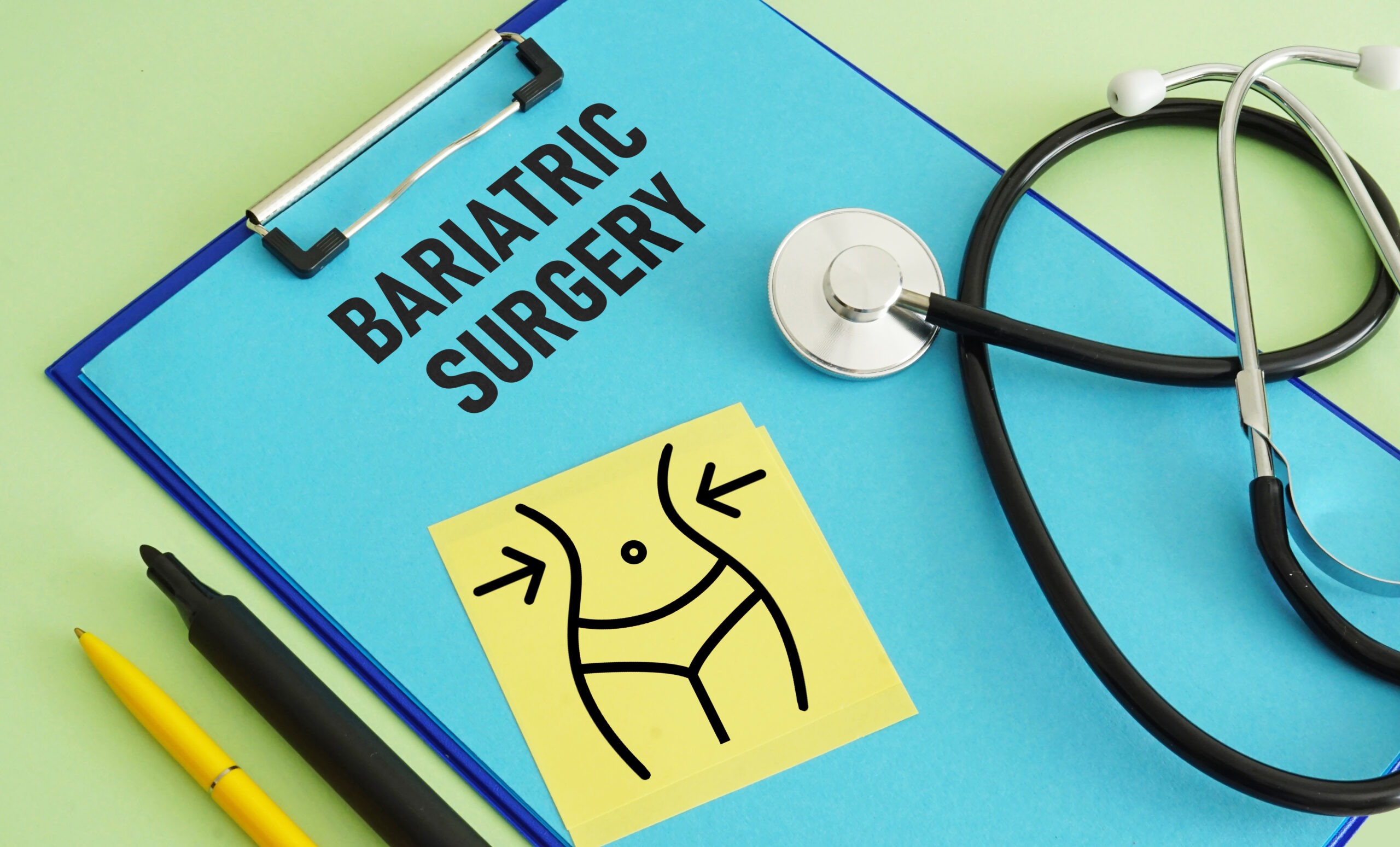bariatric-surgery-is-shown-using-the-text
