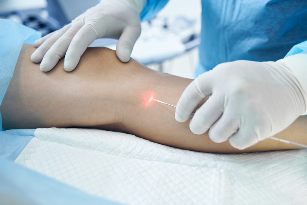 Laser treatment