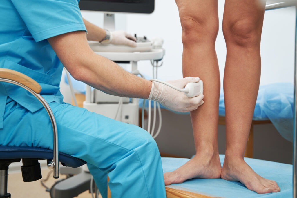 does vein treatment hurt - Beltline Health